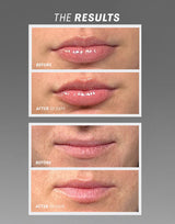 Lip Oasisᵀᴹ Glossy Treatment